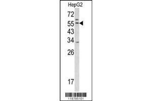 Image no. 1 for anti-Transmembrane Protease, serine 2 (TMPRSS2) (AA 314-343) antibody (ABIN391564)