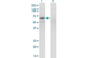 MAGEB6 antibody  (AA 135-244)