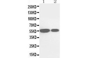Image no. 1 for anti-Cytochrome P450, Family 2, Subfamily E, Polypeptide 1 (CYP2E1) (AA 94-112), (N-Term) antibody (ABIN3044118)