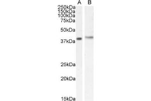 Image no. 3 for anti-Cytohesin 1 Interacting Protein (CYTIP) (N-Term) antibody (ABIN184711)