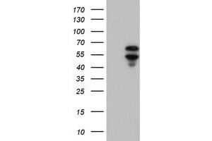 Image no. 2 for anti-Adrenocortical Dysplasia Homolog (ACD) antibody (ABIN2715647)