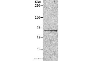 Image no. 1 for anti-Potassium Voltage-Gated Channel, Shaw-Related Subfamily, Member 3 (KCNC3) antibody (ABIN2431567)