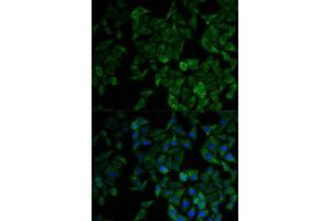 Immunofluorescence analysis of HeLa cell using TNFRSF1A antibody.