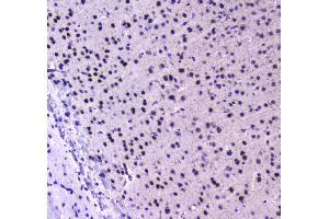 Image no. 2 for anti-Runt-Related Transcription Factor 1, Translocated To, 1 (Cyclin D-Related) (RUNX1T1) (AA 335-510) antibody (ABIN5693284)