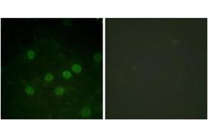 Immunofluorescence analysis of HuvEc cells treated with serum 20% 30', using Histone H1 (Phospho-Thr17) Antibody.