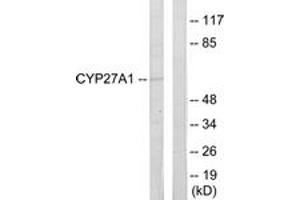Image no. 1 for anti-Cytochrome P450, Family 27, Subfamily A, Polypeptide 1 (CYP27A1) (AA 101-150) antibody (ABIN1534380)