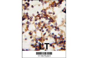 Image no. 2 for anti-RPTOR Independent Companion of mTOR, Complex 2 (RICTOR) (AA 252-281), (N-Term) antibody (ABIN391384)