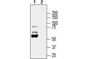 KCNK16 anticorps  (1st Extracellular Loop)
