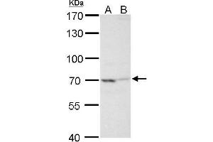 Image no. 3 for anti-TNFAIP3 Interacting Protein 2 (TNIP2) (Center) antibody (ABIN2854507)