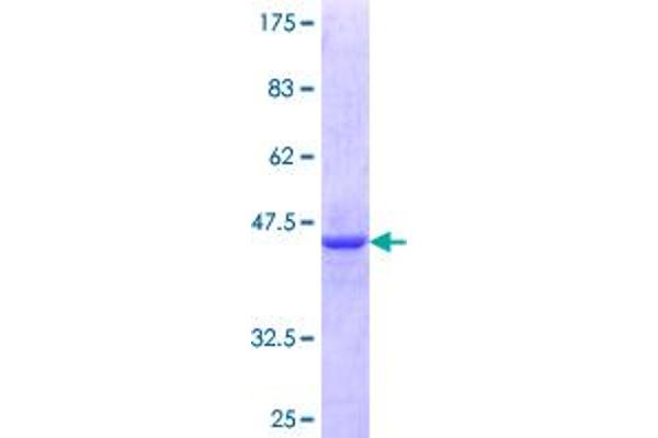 ZNF76 Protein (AA 471-570) (GST tag)
