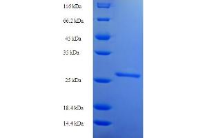 Image no. 1 for Thyroid Stimulating Hormone, beta (TSHB) (AA 21-132) protein (His-SUMO Tag) (ABIN5710554)