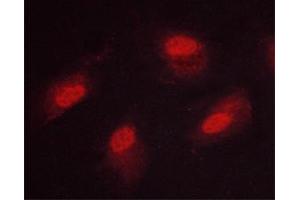 Image no. 1 for anti-Calcium/calmodulin-Dependent Protein Kinase IV (CAMK4) (pThr200) antibody (ABIN6256500)