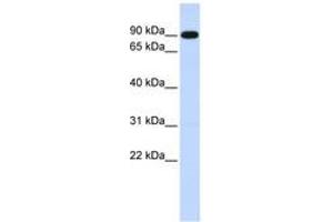 Image no. 1 for anti-Zinc Finger, X-Linked, Duplicated A (ZXDA) (C-Term) antibody (ABIN6740564)