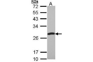 Image no. 1 for anti-Protein-L-Isoaspartate (D-Aspartate) O-Methyltransferase (PCMT1) (Center) antibody (ABIN2856765)