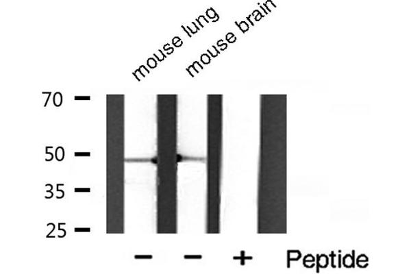 HDAC3 抗体  (pSer424)