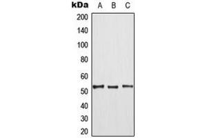 Image no. 3 for anti-Mitogen-Activated Protein Kinase Kinase Kinase 8 (MAP3K8) (pSer290) antibody (ABIN2707193)