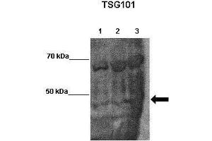Image no. 4 for anti-Tumor Susceptibility Gene 101 (TSG101) (Middle Region) antibody (ABIN2780037)