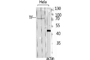 Image no. 1 for anti-Transferrin (TF) (C-Term) antibody (ABIN3187770)