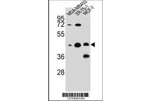 Image no. 1 for anti-Kelch Repeat and BTB (POZ) Domain Containing 13 (KBTBD13) (AA 409-438), (C-Term) antibody (ABIN656073)