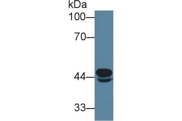 anti-Acyl-CoA Dehydrogenase, C-4 To C-12 Straight Chain (ACADM) (AA 131-421) antibody