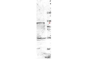 Image no. 1 for anti-Neural Precursor Cell Expressed, Developmentally Down-Regulated 4, E3 Ubiquitin Protein Ligase (NEDD4) (Internal Region) antibody (ABIN349606)