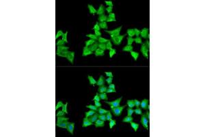 Image no. 3 for anti-Hyaluronan and Proteoglycan Link Protein 1 (HAPLN1) antibody (ABIN6141602)