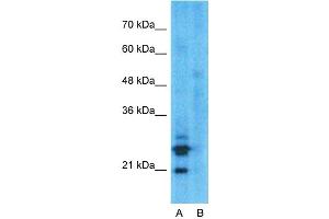 Image no. 9 for anti-Mucin 1 (MUC1) (C-Term) antibody (ABIN2776819)