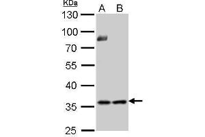 Image no. 1 for anti-Thymidylate Synthetase (TYMS) (Center) antibody (ABIN2855587)