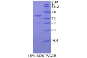 Image no. 1 for zeta-Chain (TCR) Associated Protein Kinase 70kDa (ZAP70) (AA 270-560) protein (His tag) (ABIN1877290)