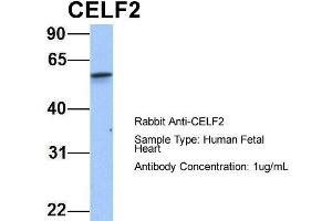 Image no. 3 for anti-CUGBP, Elav-Like Family Member 2 (CELF2) (N-Term) antibody (ABIN2778746)