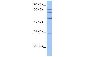 Image no. 2 for anti-Testis-Specific serine Kinase Substrate (TSKS) (N-Term) antibody (ABIN631260)