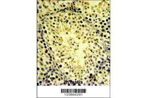 Immunohistochemistry (IHC) image for anti-Diacylglycerol Kinase, kappa (DGKK) antibody (ABIN2158541)