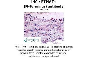 Image no. 1 for anti-Protein Tyrosine Phosphatase, Mitochondrial 1 (PTPMT1) (N-Term) antibody (ABIN1738592)