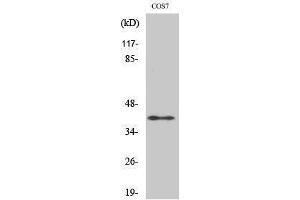 Image no. 1 for anti-Alcohol Dehydrogenase 7 (Class IV), mu Or sigma Polypeptide (ADH7) (Internal Region) antibody (ABIN3183193)