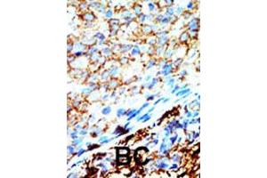 Image no. 2 for anti-NME/NM23 Nucleoside Diphosphate Kinase 4 (NME4) (AA 158-187), (C-Term) antibody (ABIN392785)