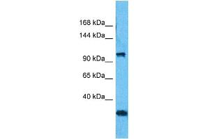 Image no. 1 for anti-MORC Family CW-Type Zinc Finger 3 (MORC3) (C-Term) antibody (ABIN5517173)