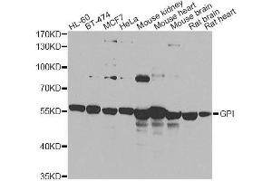Image no. 4 for anti-Glucose-6-Phosphate Isomerase (GPI) antibody (ABIN6141326)