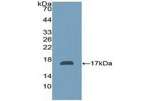 Image no. 2 for alpha-2-Glycoprotein 1, Zinc-Binding (AZGP1) ELISA Kit (ABIN6720602)