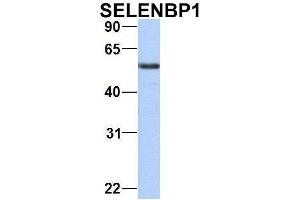 Image no. 6 for anti-Selenium Binding Protein 1 (SELENBP1) (C-Term) antibody (ABIN2783295)