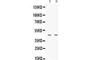 Image no. 3 for anti-Apolipoprotein B mRNA Editing Enzyme, Catalytic Polypeptide-Like 3G (APOBEC3G) (AA 191-384) antibody (ABIN4886468)