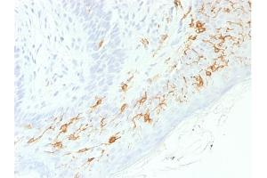 Image no. 3 for anti-CD1a (CD1a) antibody (ABIN6941004)