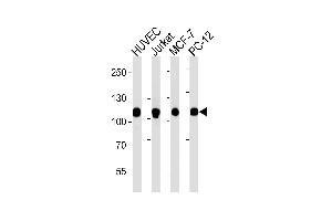 Image no. 1 for anti-Topoisomerase (DNA) I (TOP1) (N-Term) antibody (ABIN1882055)