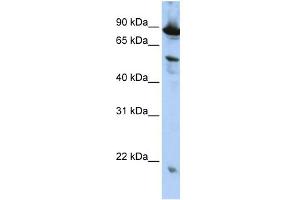 Image no. 1 for anti-Zinc Finger, CCCH-Type with G Patch Domain (ZGPAT) (N-Term) antibody (ABIN2775532)