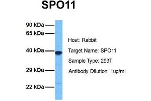 Image no. 1 for anti-SPO11 Meiotic Protein Covalently Bound To DSB Homolog (SPO11) (N-Term) antibody (ABIN2785945)