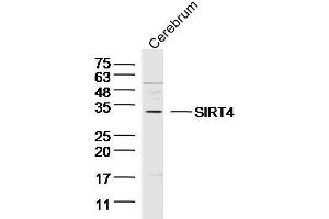 Image no. 3 for anti-Sirtuin 4 (SIRT4) (AA 51-150) antibody (ABIN872709)