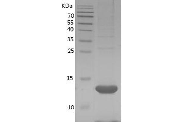 SAA Protein (AA 18-122) (His tag)