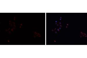 Image no. 3 for anti-Scavenger Receptor Class B, Member 1 (SCARB1) antibody (ABIN6264935)