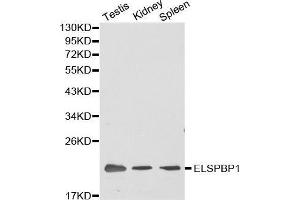 Image no. 1 for anti-Epididymal Sperm Binding Protein 1 (ELSPBP1) antibody (ABIN3023053)