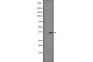 Image no. 2 for anti-Interferon-Induced Protein 35 (IFI35) (C-Term) antibody (ABIN6257353)