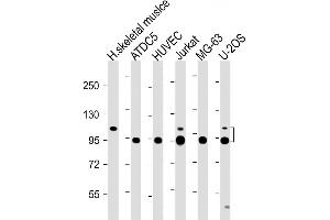 Image no. 6 for anti-Cartilage Oligomeric Matrix Protein (COMP) (AA 314-343) antibody (ABIN390893)